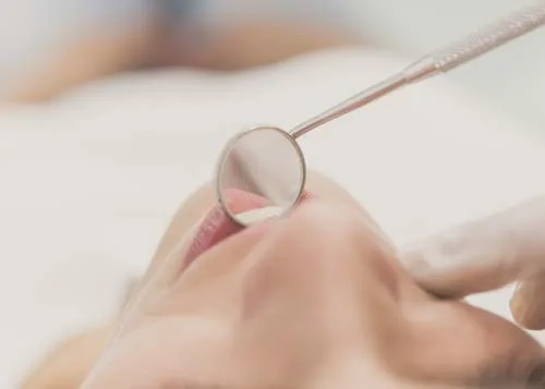 Blanqueamiento dental en Valencia