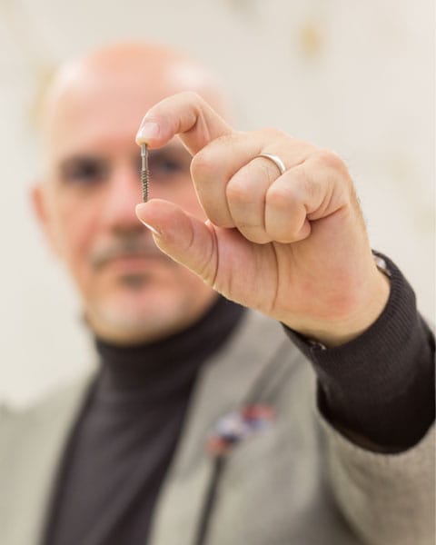 Implantes dentales Abil System en Valencia