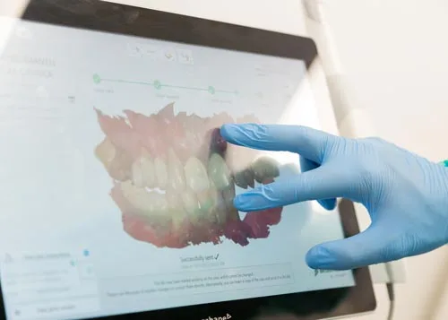Estética dental en Valencia
