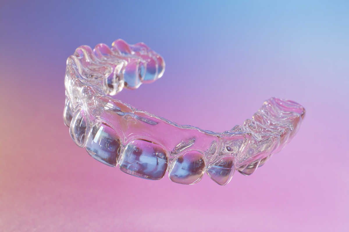 Proceso paso a paso ABIL System® (línea de tiempo)