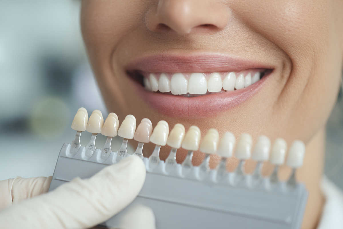 Comparativa visual: carga inmediata vs. convencional (esquema)