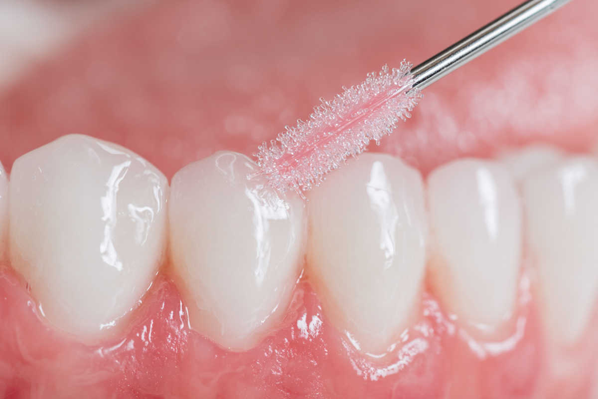 Sedación consciente en clínica (ambiente relajado) Sedación consciente en clínica (ambiente relajado)