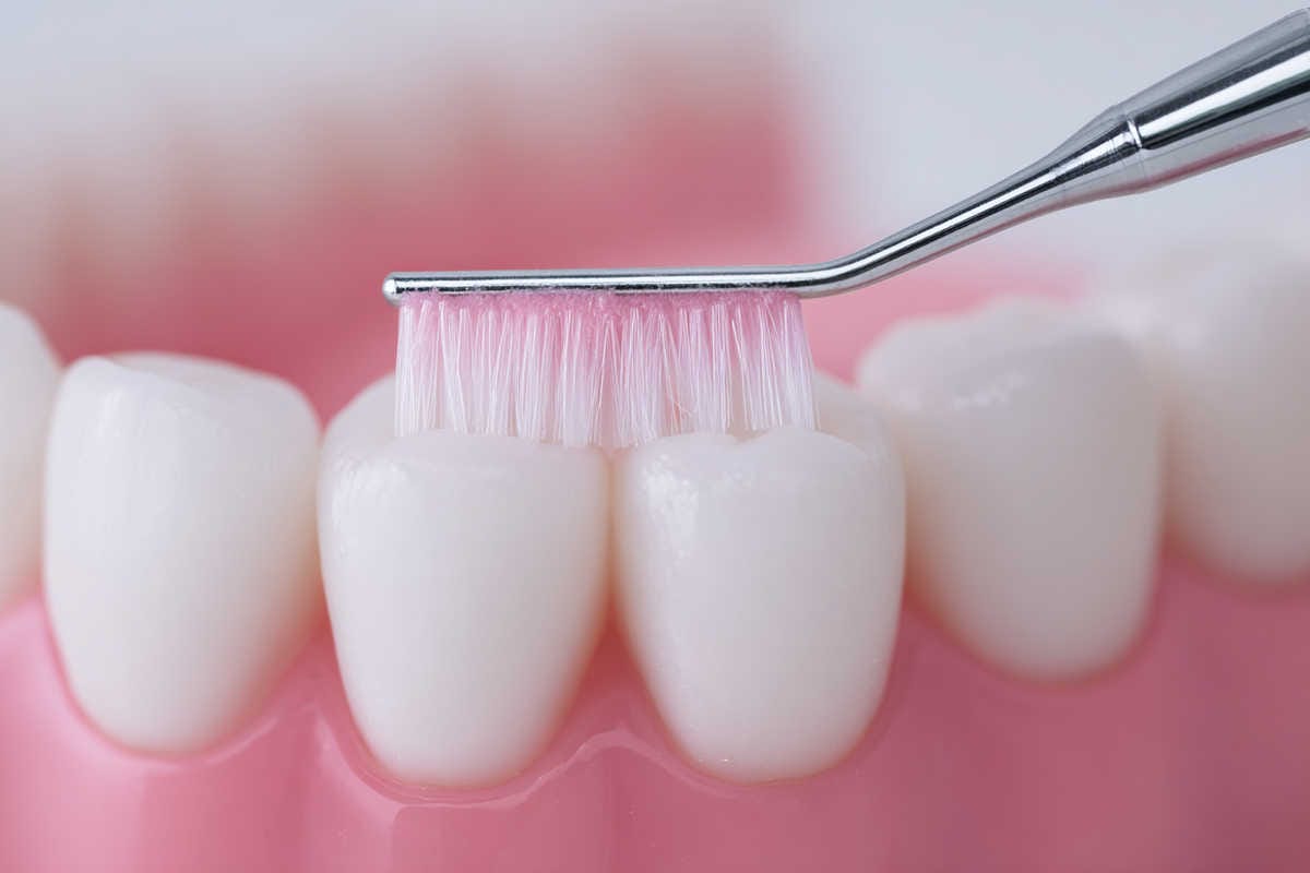 Zonas de anclaje basal (infografía divulgativa) Zonas de anclaje basal (infografía divulgativa)